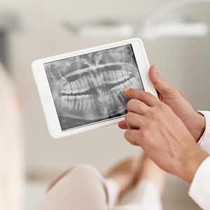 X-Ray of teeth shown on tablet