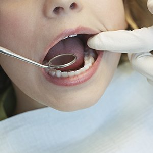 Person getting dental checkup