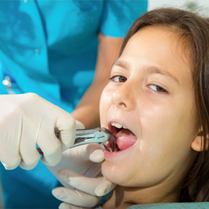 Young girl receiving tooth extraction
