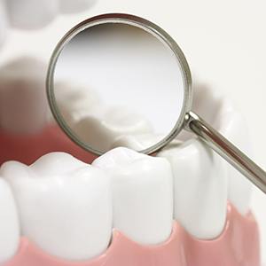 dental mirror resting on teeth model