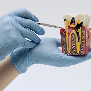 Gloved hands holding cross-section tooth model