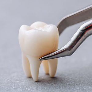 Close-up of dental forceps around extracted tooth