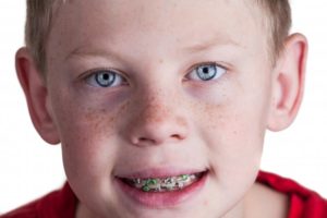 Young boy with braces.