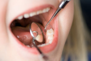 Child getting ready for dental X-rays at checkup